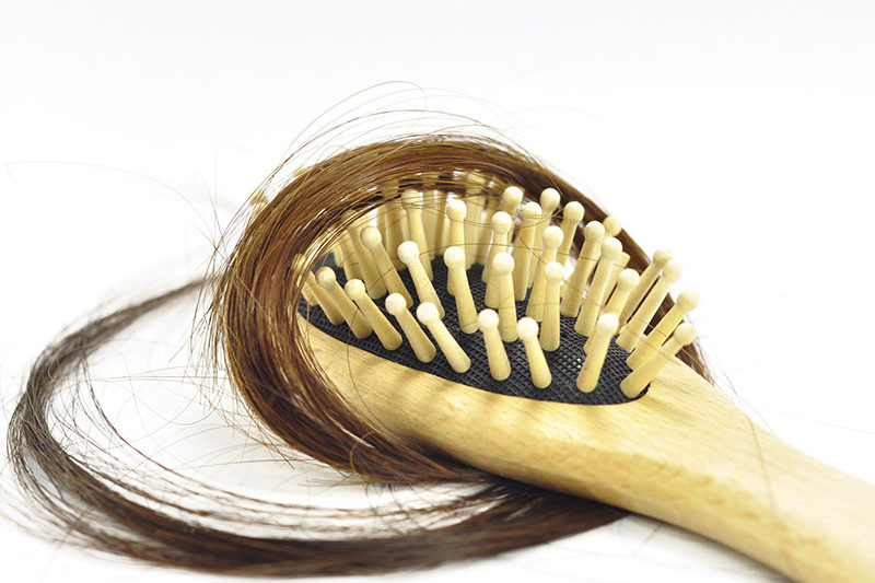 Hair loss